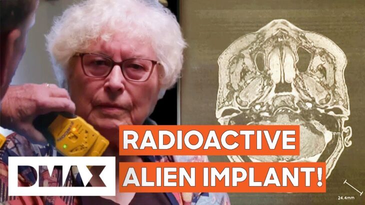 2024年 Radioactive Alien Implants Discovered Inside Woman Confirms UFO Encounter | UFO Witness