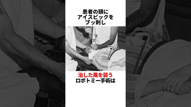 【ロボトミー手術】実はノーベル賞を受賞している #都市伝説 #雑学